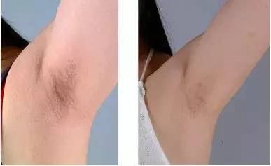 日本哪款脱毛膏脱毛效果好,推荐超好用的脱毛膏