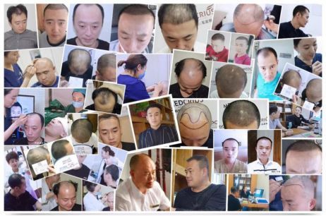 报道来了！28岁小伙“秃”成50岁？过年前抓紧……芜湖全面启动