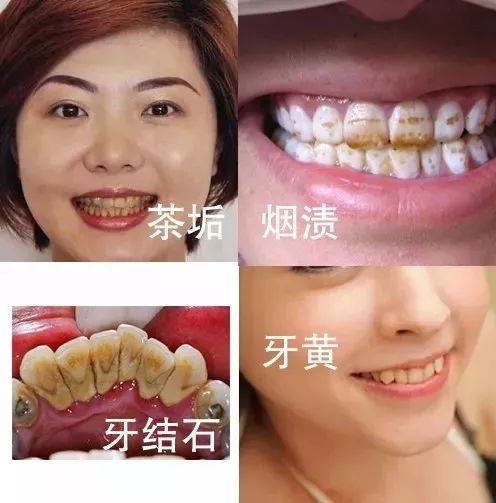 公认去牙黄最好的牙膏老爸评测,去牙渍去口气的牙膏测评