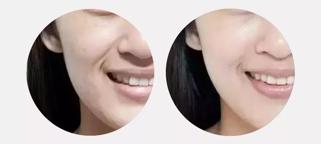 植物主义儿童保湿蜜桃面膜,乳酸菌补水嫩肤蜜桃面膜