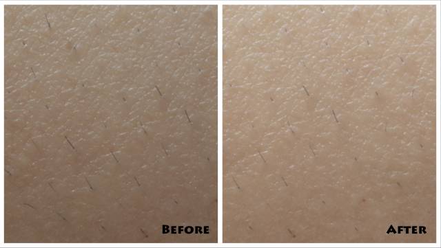 10分钟永久全身脱毛，给你一个滑溜溜的夏天