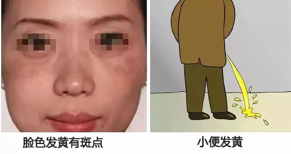 小心肝护肝茶有用吗,小心肝茶叶是什么茶