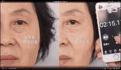 解决眼袋只需3步,不管眼袋多严重用点它