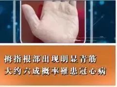 为什么手下垂手背上青筋暴露出来,手血管突出青筋暴起是什么原因