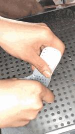 刚出生就要打石膏？硬核医生手工打造矫形器治疗足外翻