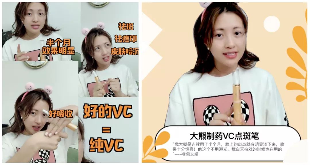 严重痘印晒斑,5个祛斑小妙招淡化晒斑雀斑痘印