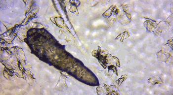 为什么能从鼻头上挤出白色的东西,鼻子挤出来的白丝是什么