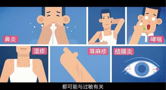 警惕过敏的10个征兆,突发过敏的症状和判断方法