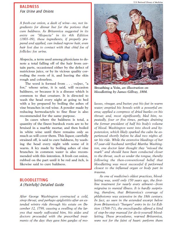 吸血鬼治脱发秘方,吸血鬼疗法治疗脱发