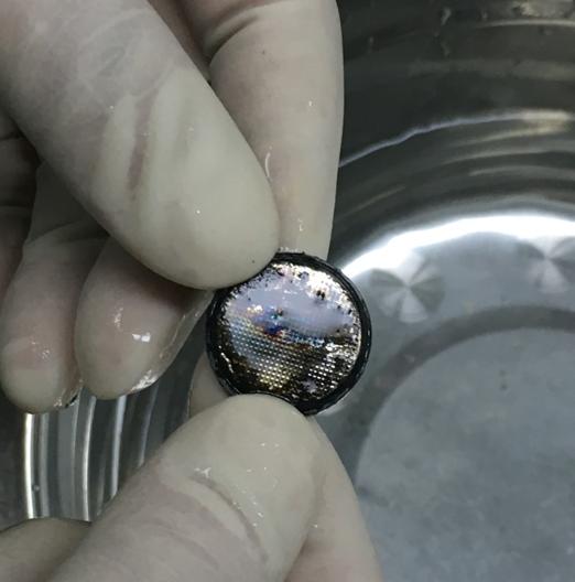 惊险！温州一婴儿连续几天吐血竟是误食了一根针！