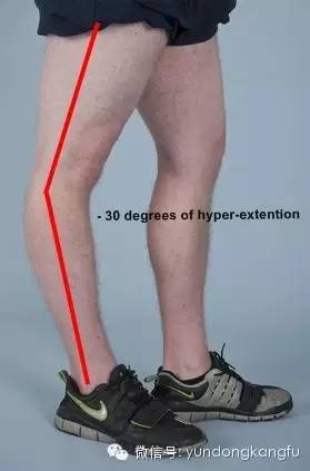 膝腓侧副韧带损伤怎么恢复,膝内侧副韧带损伤修复视频