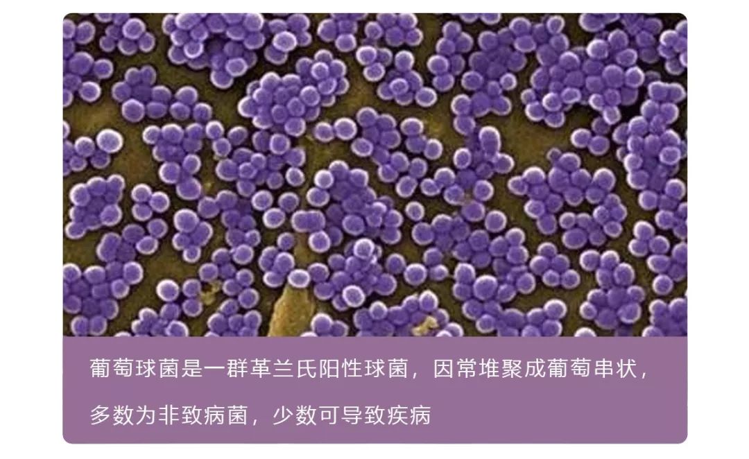 朋友有狐臭,我会不会被传染呢?