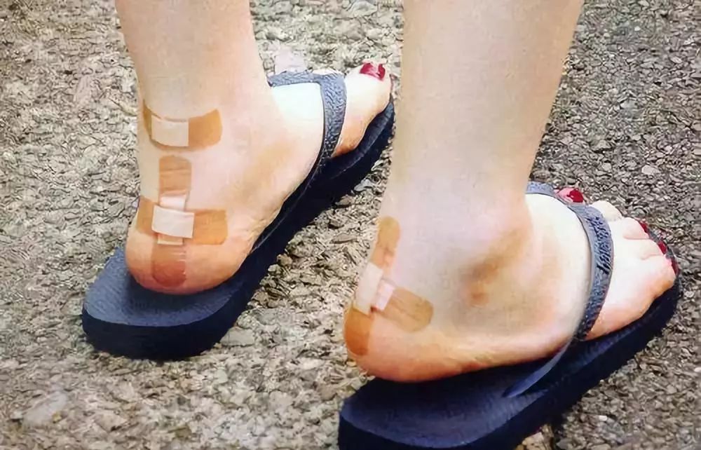 为什么女生的脚后跟那么容易磨破,脚后跟的心酸血泪史