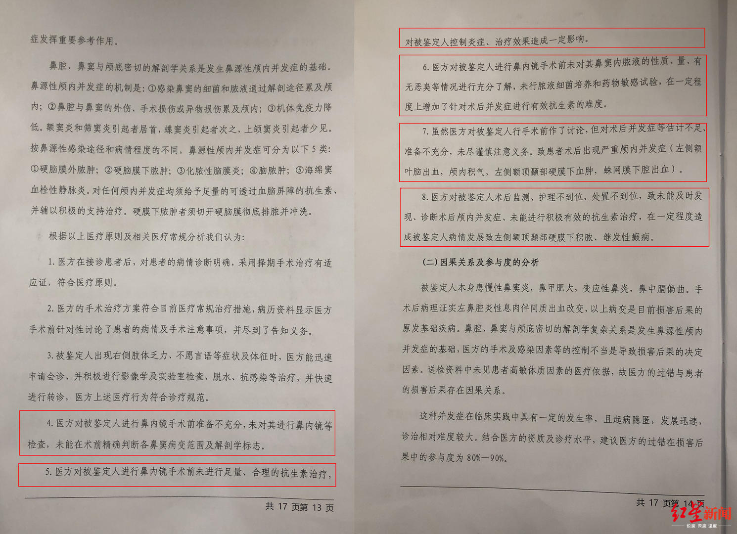 武汉大学生因鼻窦炎手术致智力障碍家长医院陷赔偿僵局