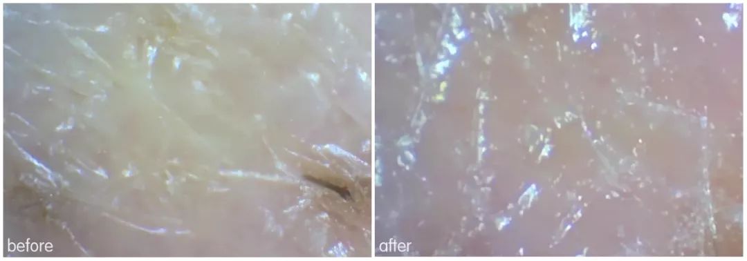 灏忚寕鑲岃瘖瀹よˉ姘村悧,灏忚寕鑲岃瘖瀹ゅ埌搴曟湁澶氬己