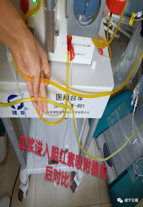 厉害了！这是什么黑科技？能吸走血液里的致病物？