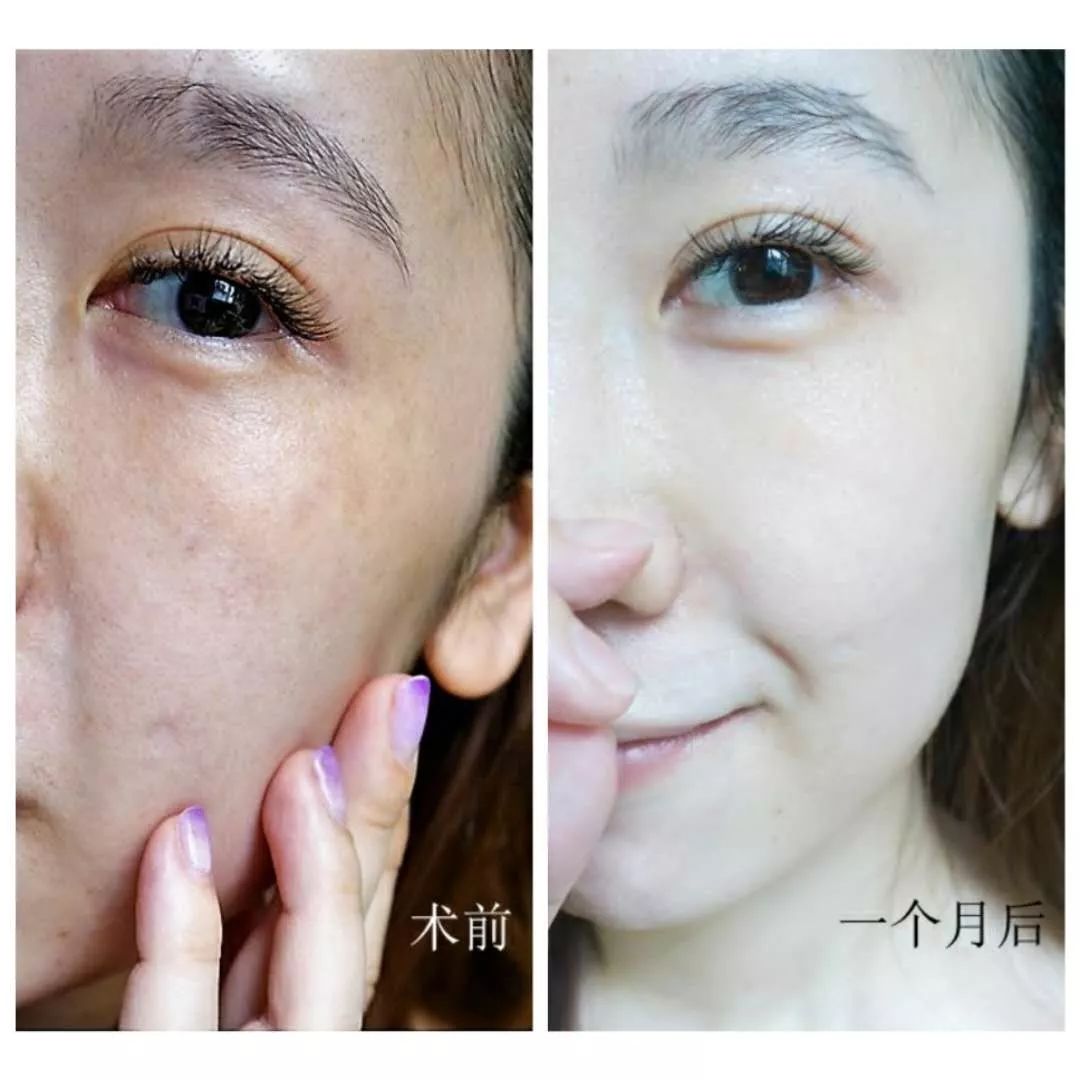 怀孕变丑真正原因,什么时候怀孕变难看