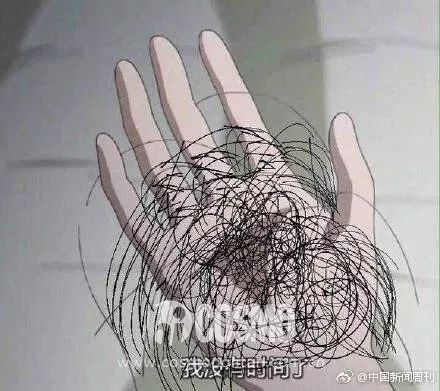 刘亦菲自曝戴假发片,刘亦菲秃顶引热议