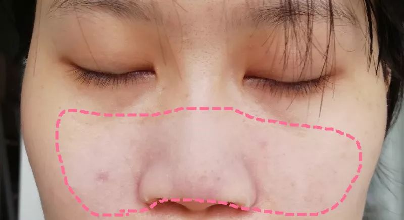 盲测14天揭密|年轻肌特训营收关，那瓶好评如潮的精华水究竟是谁？