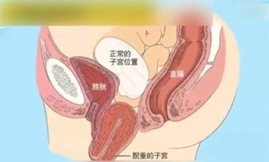 吓人！男子酒后呕吐出大肉团！医生：是肿瘤！更奇葩的是...