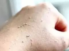 洗澡搓出泥的正确方法,洗澡搓下来的泥是什么