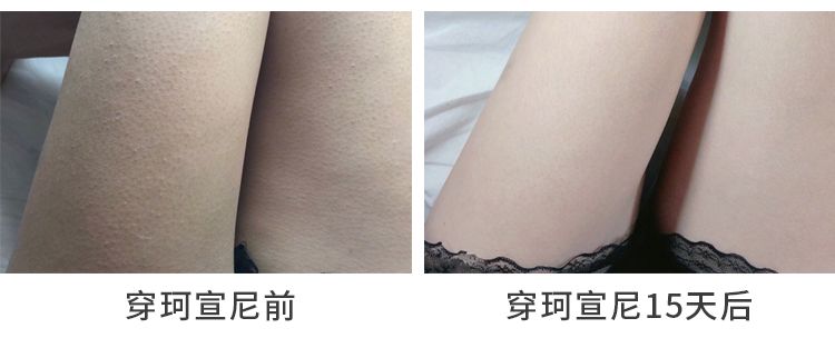 明星都在穿的不显腿粗的裤子,整个娱乐圈都在穿什么裙子