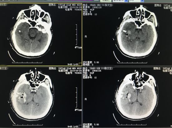 打开一扇“小窗”，还您身体健康！
