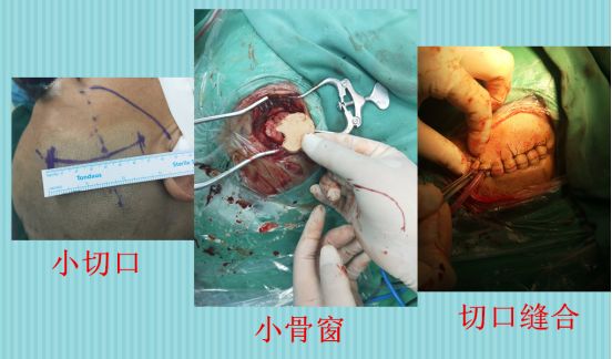 打开一扇“小窗”，还您身体健康！