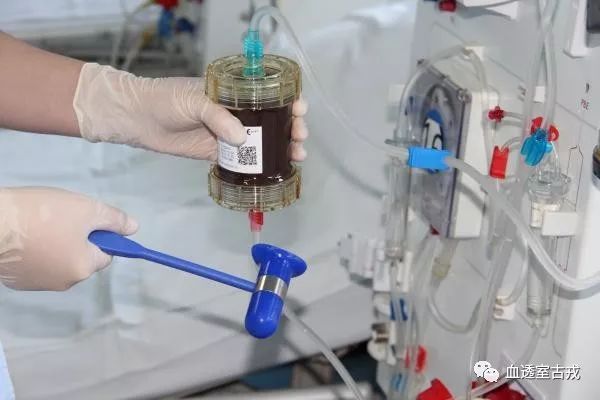 灌流是怎么回事,血液灌流为什么只能做2个小时