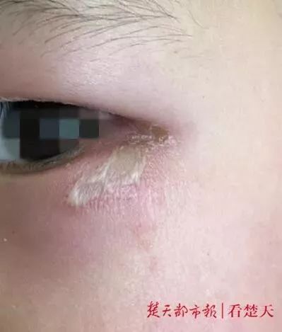 女孩随手拍了一只虫子,不能随便用手拍死的虫子有哪些