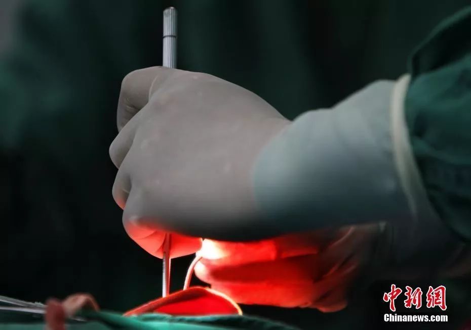 采耳最好的技术,关于友谊的科普知识