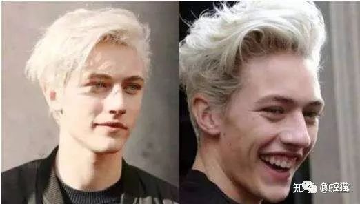 一笑露牙花子能矫正么,一笑就露出牙花怎么办