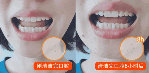 牙龈上火、红肿，还口臭？香港人用了91年的中药牙膏，消炎抑菌，让你刷出一口健康好牙