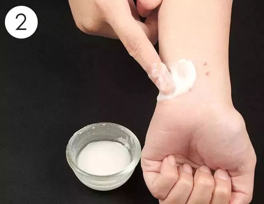 总被蚊子咬?涂点这个马上止痒,还不花一分钱