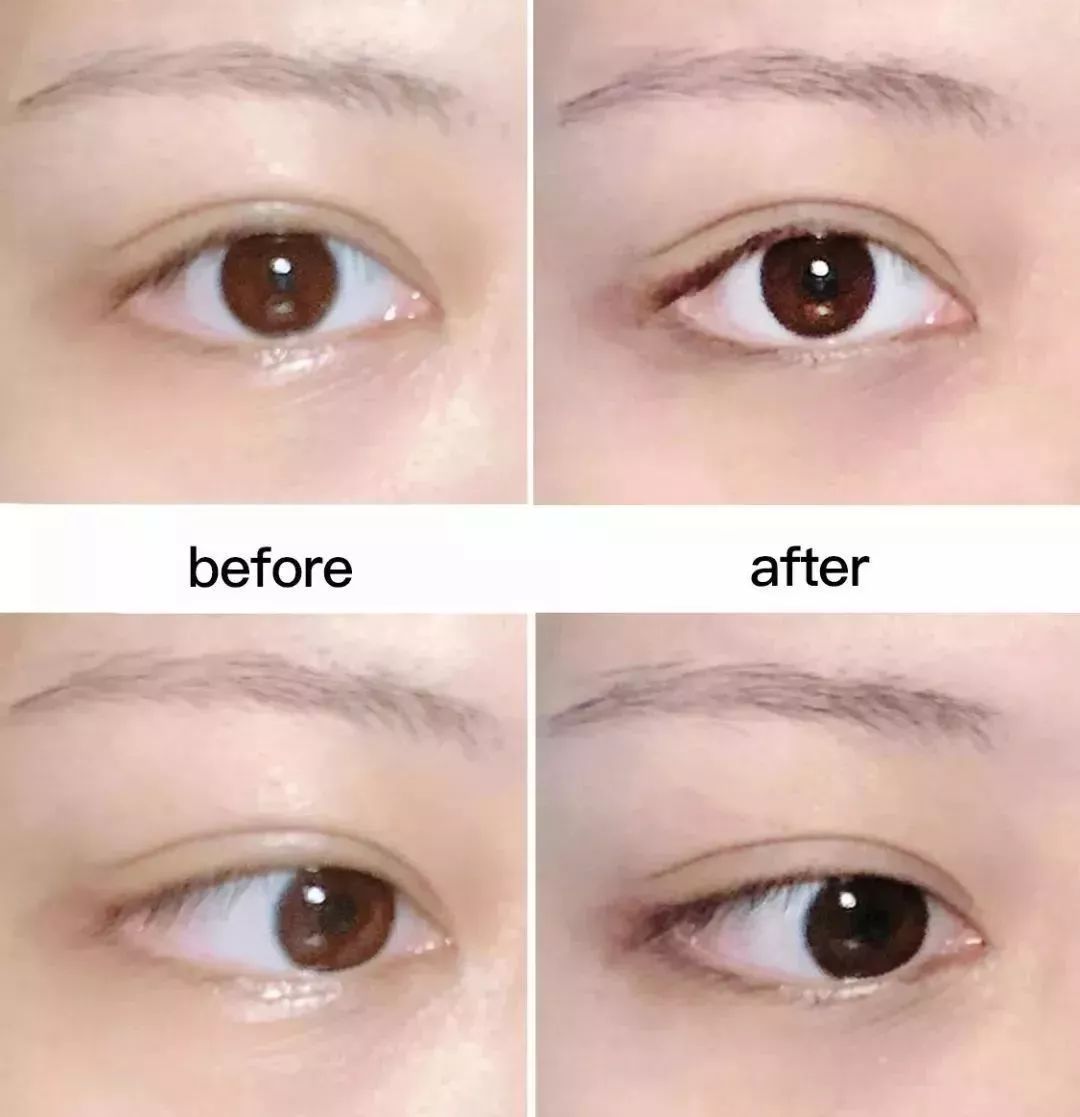 雅诗兰黛小棕瓶眼部精华618活动,618好物节雅诗兰黛小棕瓶精华