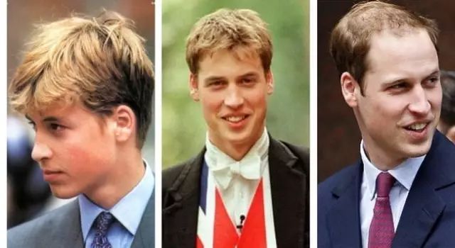 洗发水推荐防脱发超市,超市推荐洗发水防止脱发