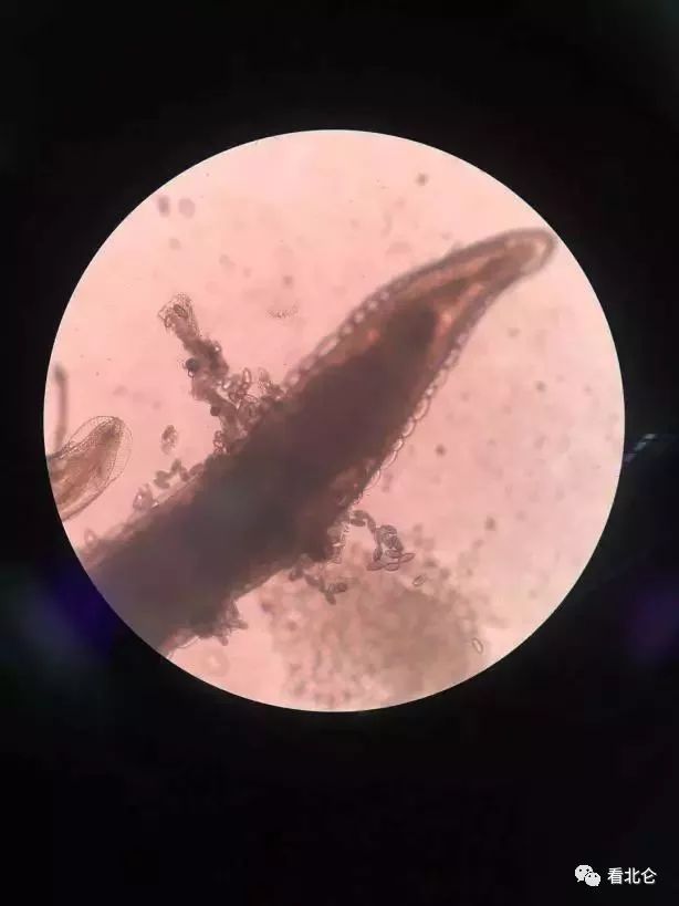 宝宝屁股痒痒怎么止痒,宝宝屁股痒怎样止痒