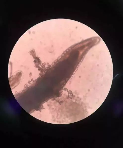 孩子屁股痒怎样快速止痒,孩子晚上屁股痒怎么快速止痒