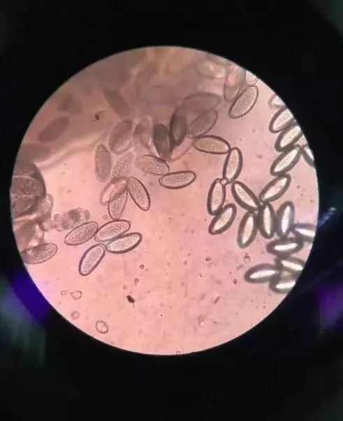 四岁女宝宝总说小便处痒,女宝宝每天说屁痒用什么药