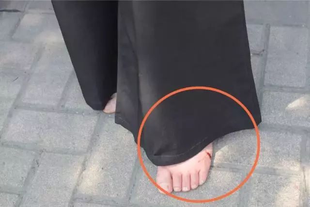 8厘米?女司机连撞3车伤1人!又是它惹的祸!