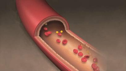 小编推荐一些健康食物,溶栓降脂吃什么好