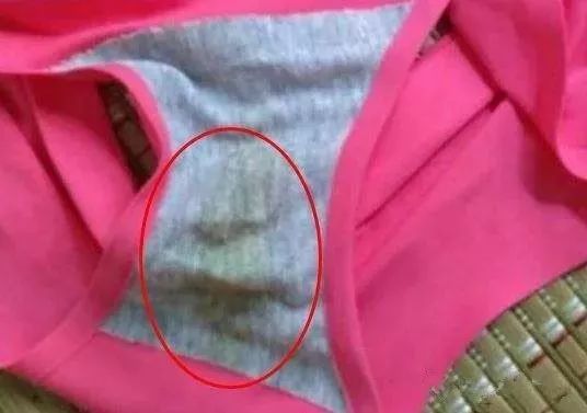 无痕裤为什么无痕,内衣裤处瘙痒小妙招