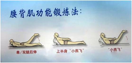 骨盆前倾医学解释,骨盆后倾引起腰痛康复