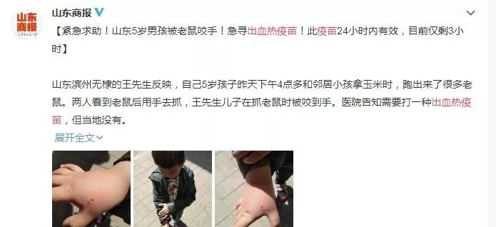 老鼠出血热疫苗多少钱一针,吃了老鼠咬过的东西会得出血热吗