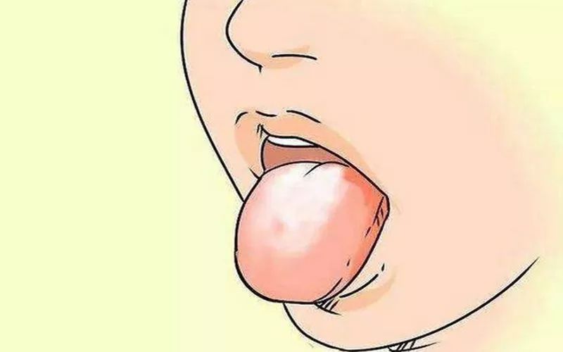 身体沉重没精气神,身体无力身上老是长痘痘