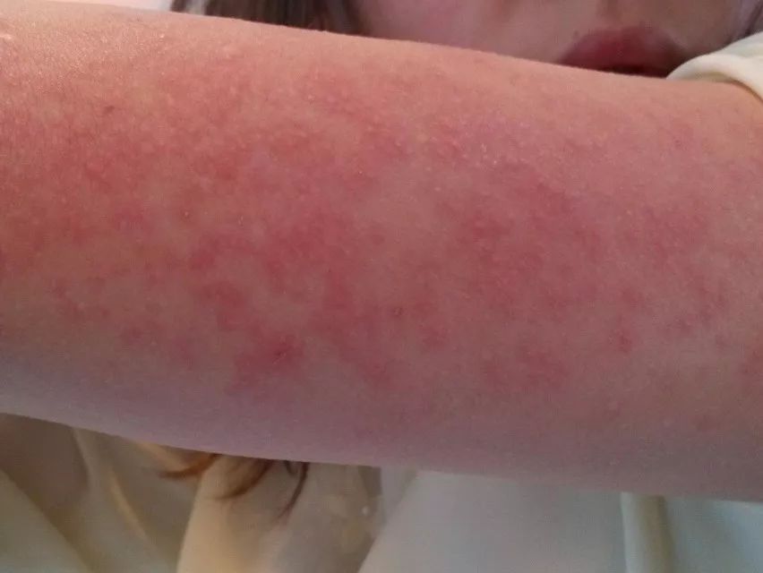 洗衣机污垢和霉菌,洗衣机加水有厕所味儿