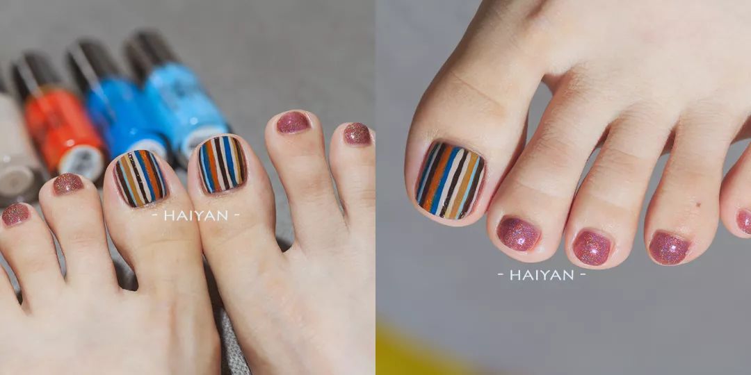 怎么治疗灰趾甲才能彻底不反复,如何快速自然地摆脱指甲真菌