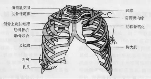 胸部ct解剖结构,胸部x线解读视频
