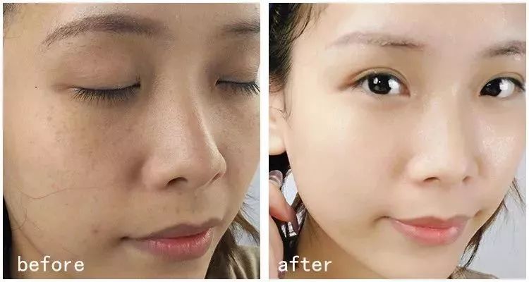 如何改善色斑暗沉问题,面色暗沉色斑多如何改善