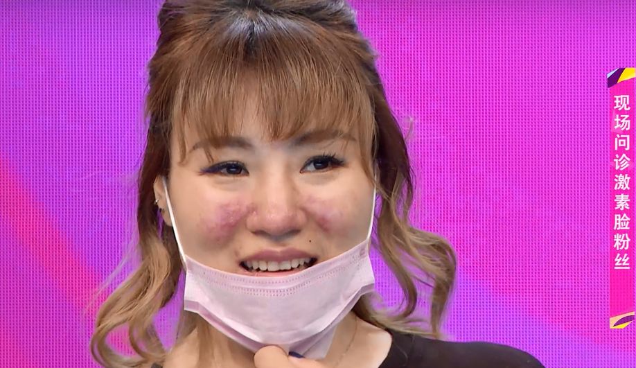 断货王祛痘胶囊,秒杀祛痘化妆品一元